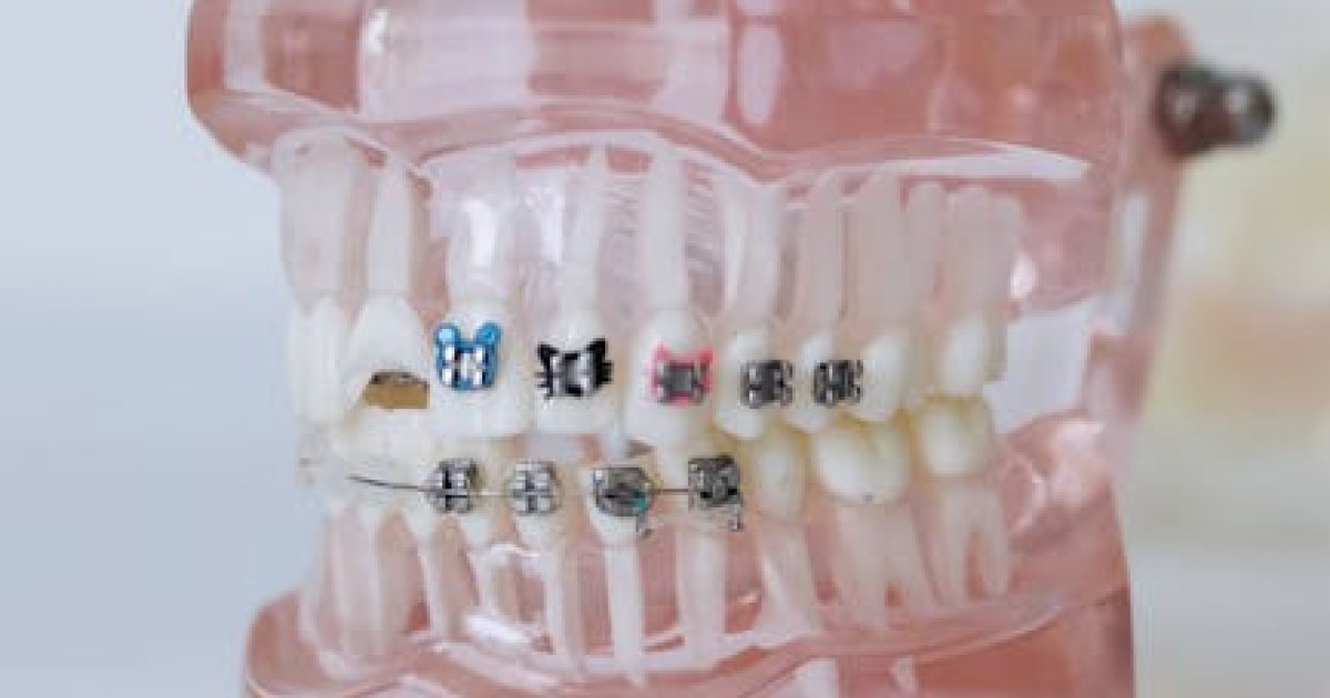 5 Common Myths About Sonrisa Perfecta Ortodoncia Debunked