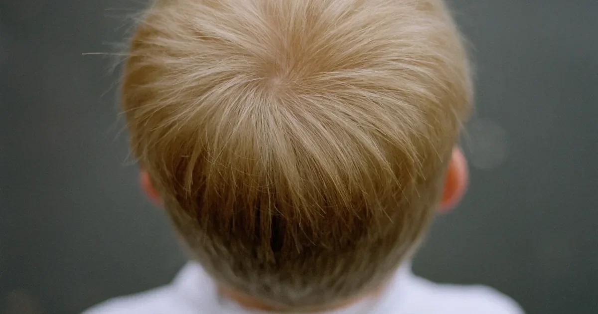 Parents May Be Able to Lower Kids’ Autism Risk