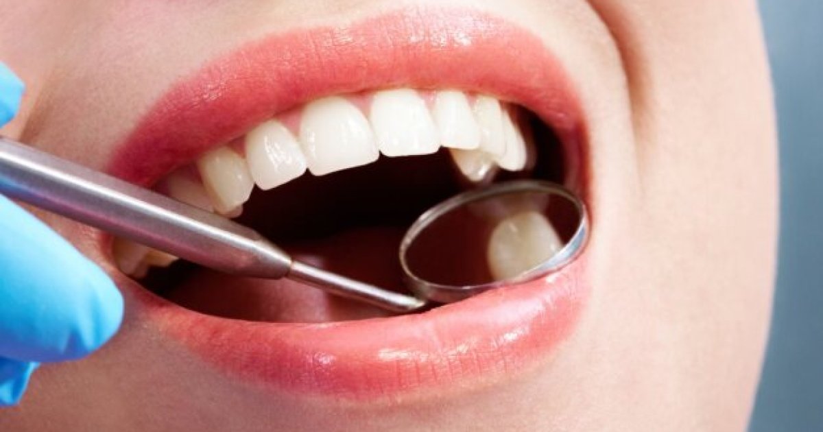 5 Easy Tips to Keep Your Teeth Clean and Sparkling