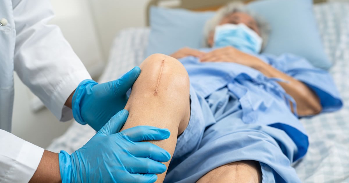 Knee Replacement Recovery Tips for Seniors: A Practical Guide
